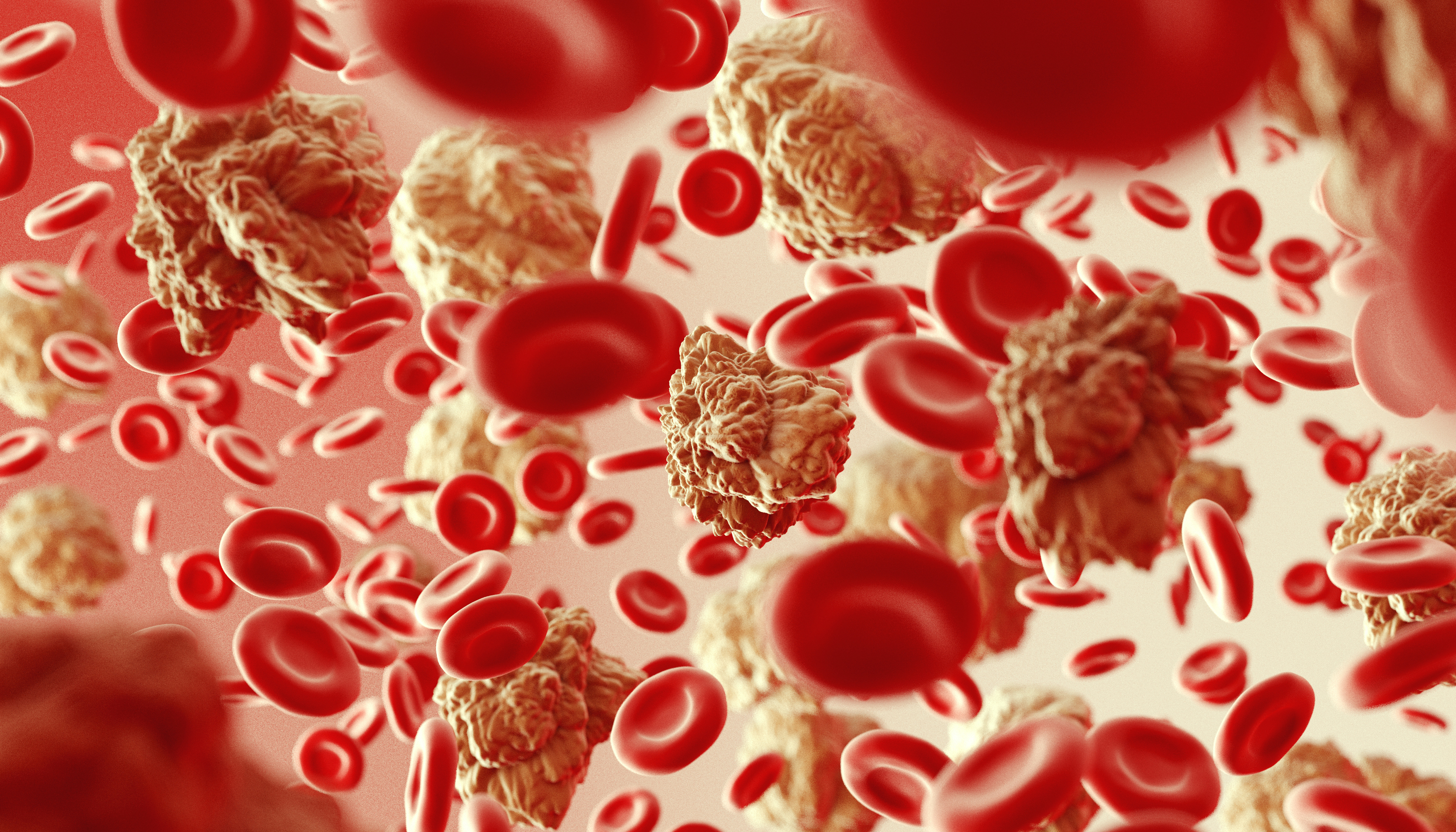 types of blood cancer