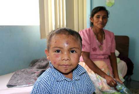 José izabel Lorenzo  permanece recluido en Hospital Nacional de Jalapa, en compañía de su madre.