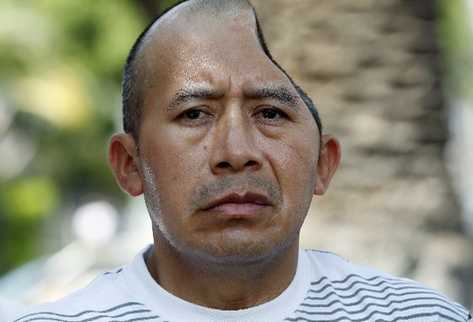 Antonio López Chaj no puede hablar, parte de su cerebro y su cráneo fueron removidos, por la cantidad de coágulos formados.