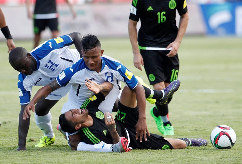 Luis Garrido sufrió una grave lesión en el duelo entre Honduras y México. (Foto Prensa Libre: AP)