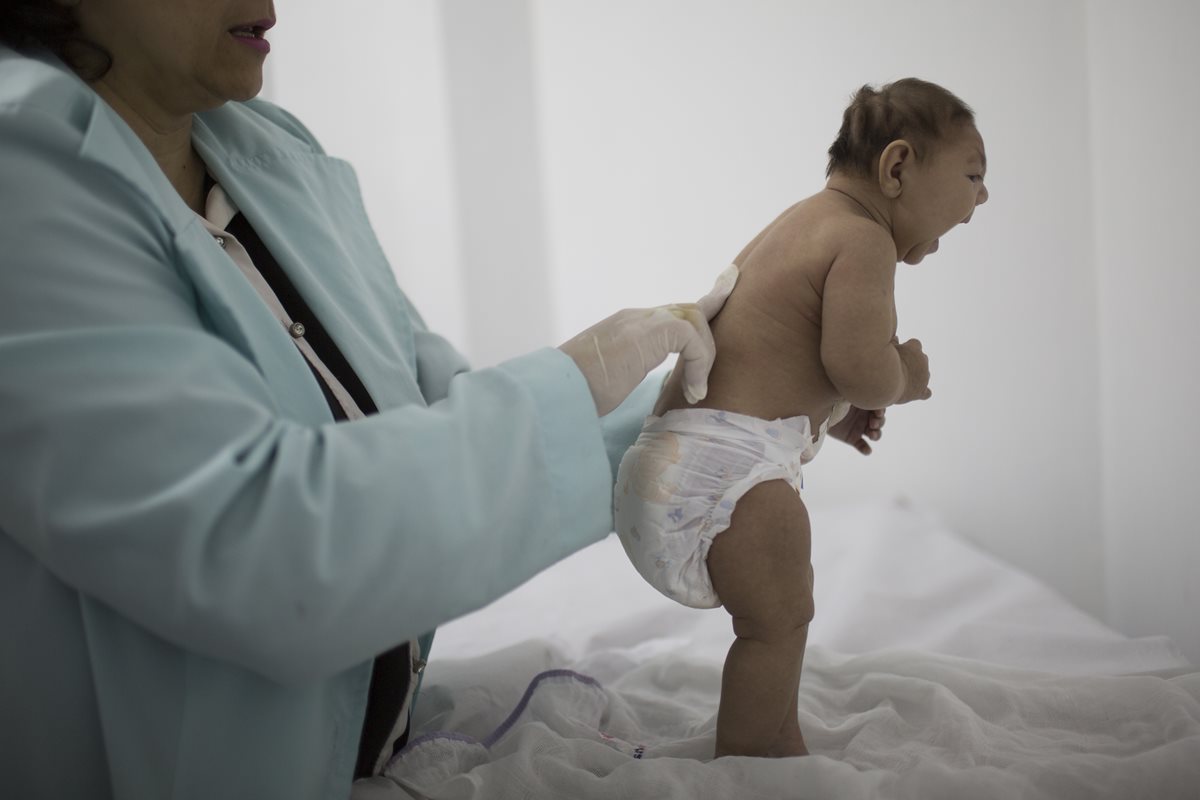Estudios brasileños identifican el virus del Zika en bebés con microcefalia. (Foto Prensa Libre: AP).