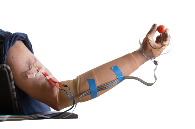 Después de un tratamiento de fisioterapia los voluntarios del estudio eran capaces de realizar un abanico de movimientos mucho más amplio.
