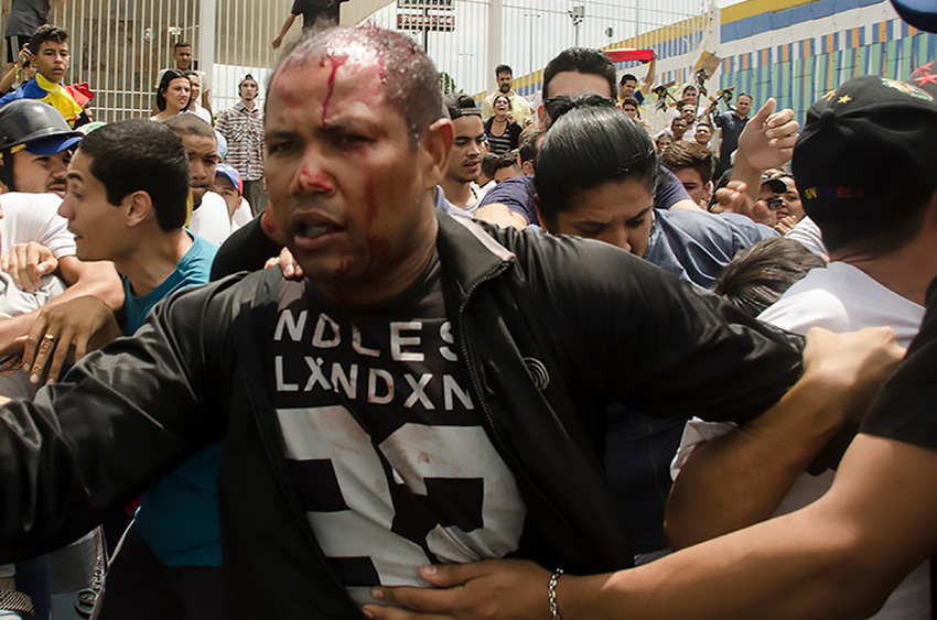 Danny José Subero, 34 años, luego de ser golpeado en Cabudare, Venezuela, murió en el estado Lara, en el oeste de Venezuela, a manos de un grupo de personas que lo golpeó y le disparó en varias ocasiones (Foto Prensa Libre: EFE).