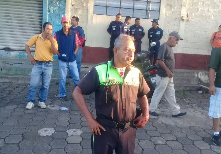 El agente de la PMT Julio Leonel Cordero Díaz, de 55 años, resultó con golpes en el rostro. (Foto Prensa Libre: Cristian Soto)