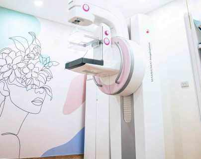 Mamografía: un paso adelante contra el cáncer de mama