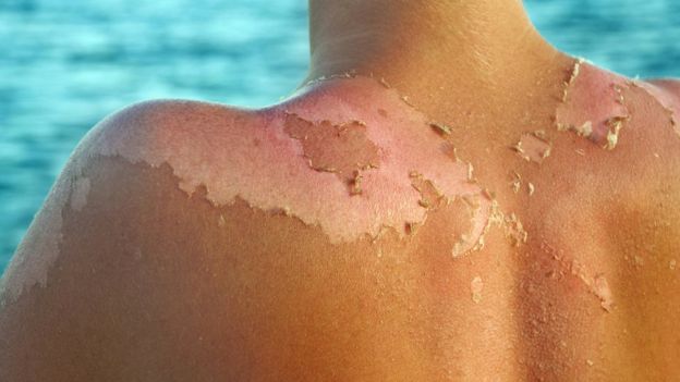 La aplicación que te dice cuánto tiempo puedes exponerte al sol sin quemarte la piel