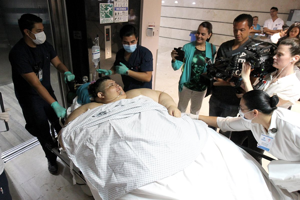 La cirugía le cambiará la vida a Juan Pedro Franco. (Foto Prensa Libre: EFE)