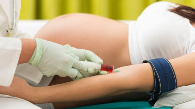 El anticuerpo de la madre que causa daños en el feto, llamado globulina hiperinmune Rh (RhIg), conocido en Australia como Anti-D, también se utiliza para producir un tratamiento para la EHRN. GETTY IMAGES