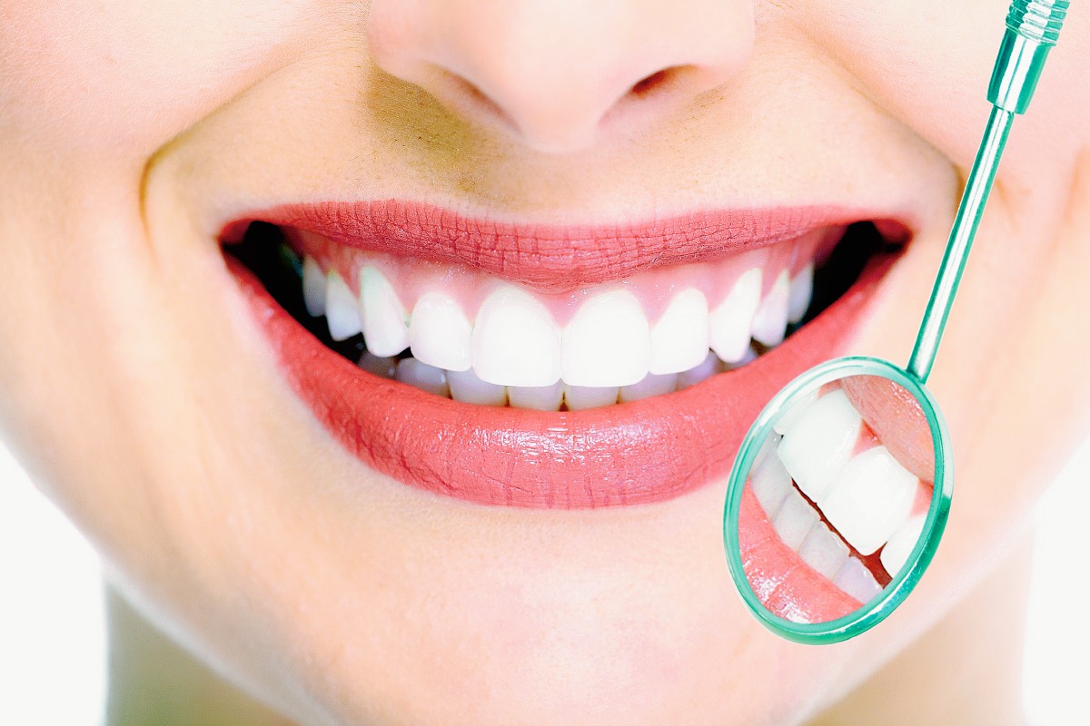 El Consultorio | Mitos y verdades de la limpieza dental