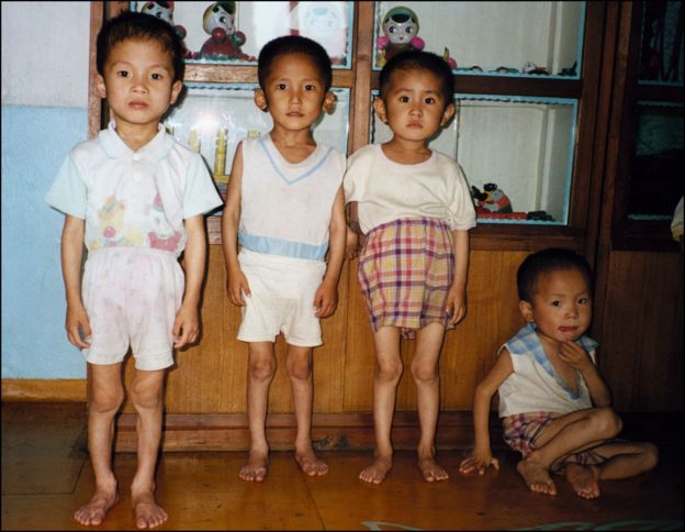 La hambruna de los años 90 en Corea del Norte causó severa desnutrición en la niñez. AFP