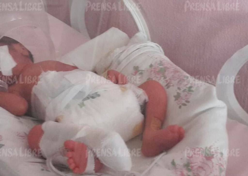 Una de las trillizas que nació en el Hospital Nacional de Retalhuleu. (Foto Prensa Libre: Rolando Miranda)
