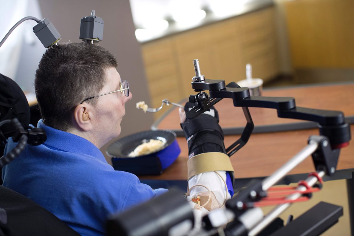 Tetrapléjico de 53 años logra realizar movimientos autónomos como comer y beber. (Foto Prensa Libre, AFP)