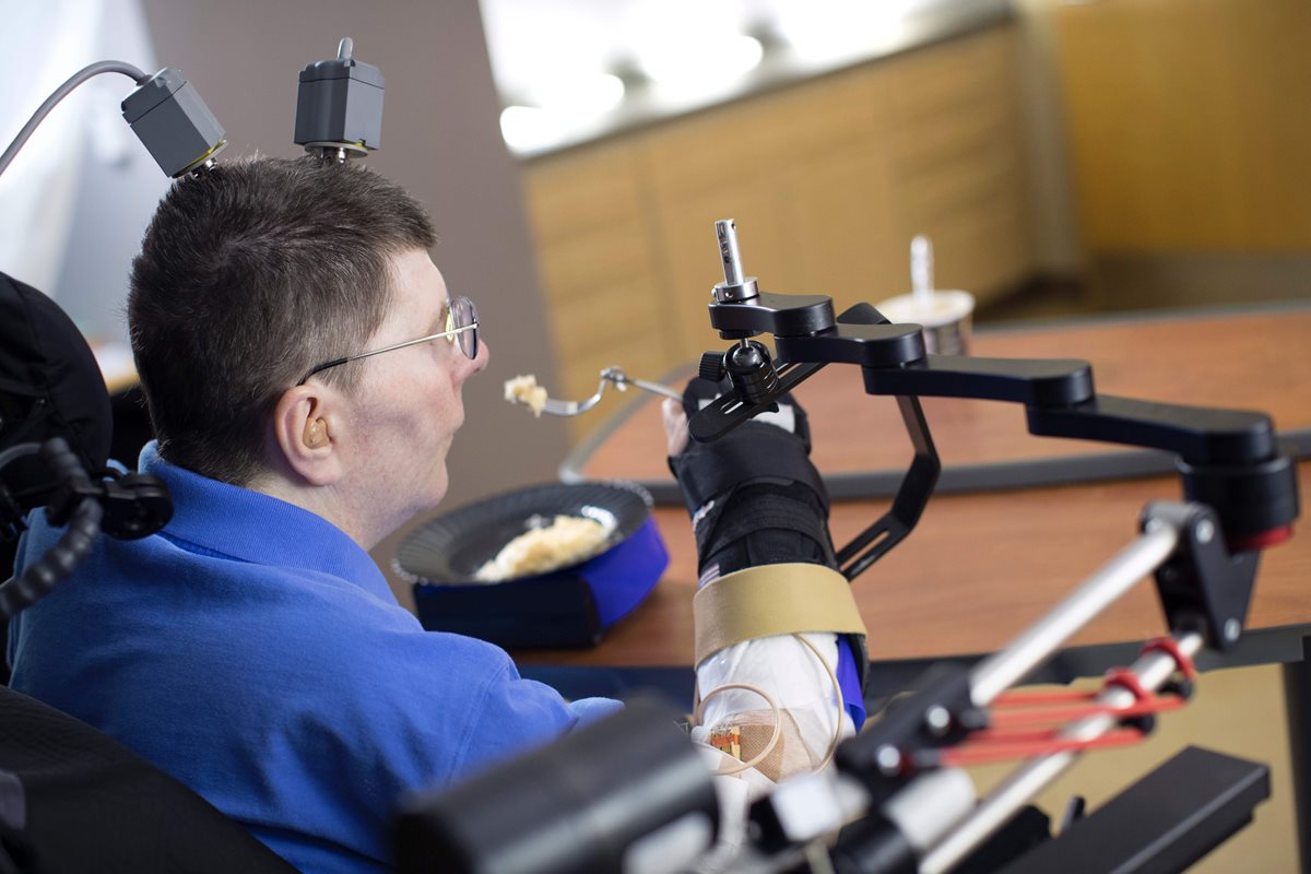 Tetrapléjico de 53 años logra realizar movimientos autónomos como comer y beber. (Foto Prensa Libre, AFP)
