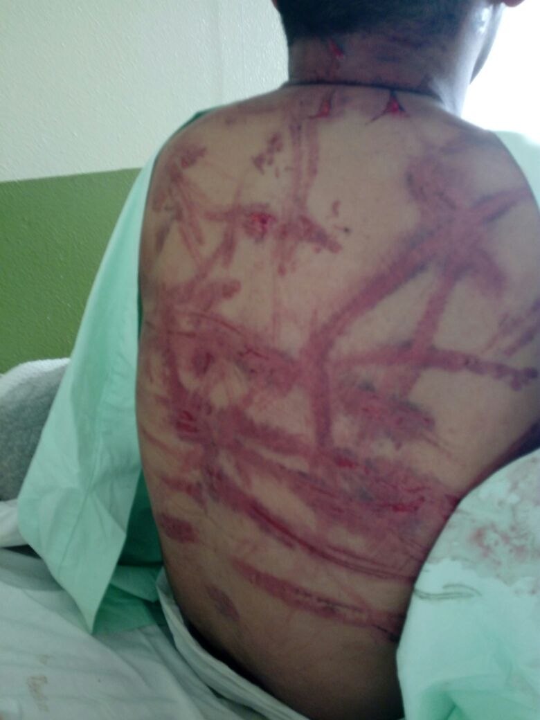 Uno de los oficiales heridos por el grupo de encapuchados.(Foto Prensa Libre: Ministerio de la Defensa)