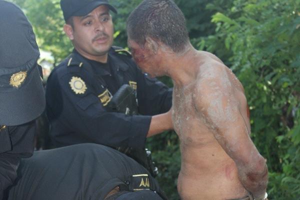 Dos agentes de la PNC de Jutiapa examinan a Duban García Yanes, quien fue vapuleado por vecinos que lo sindicaron de la muerte de Wiliam Cruz García. (Foto Prensa Libre: Óscar González).