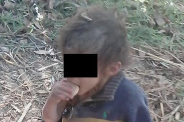 Uno de los menores rescatados que presentaban desnutrición severa en Casillas, Santa Rosa. (Foto Prensa Libre: Oswaldo Cardona)