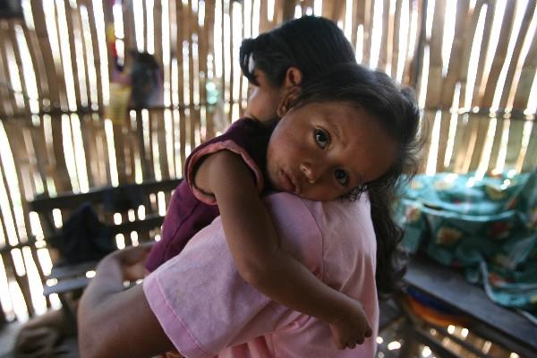 Cifras oficiales registran que siete mil 926 niños menores de 5 años padecen desnutrición aguda en el país.