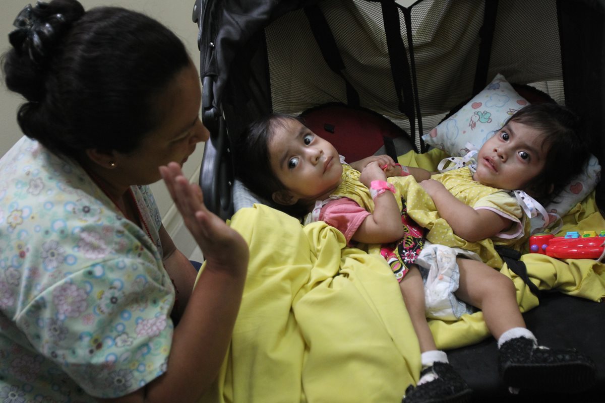 Las hermanas Aída Rosalina y Ana Rosa fueron separadas el martes de la semana pasada en el Hospital Roosevelt. (Foto Prensa Libre: Hemeroteca PL)