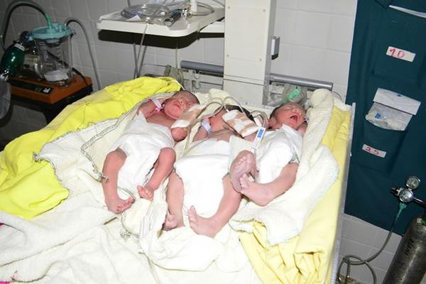 Dos varones y una niña nacieron en un parto de trillizos en el hospital de Salamá, Baja Verapaz. (Foto Prensa Libre: Carlos Grave)<br _mce_bogus="1"/>