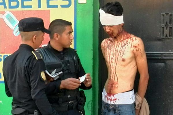 Juan Fernando Carranza, de 24 años, custodiado por la PNC luego de ser vapuleado en la zona 6. (Foto Prensa Libre: Estuardo Paredes)<br _mce_bogus="1"/>