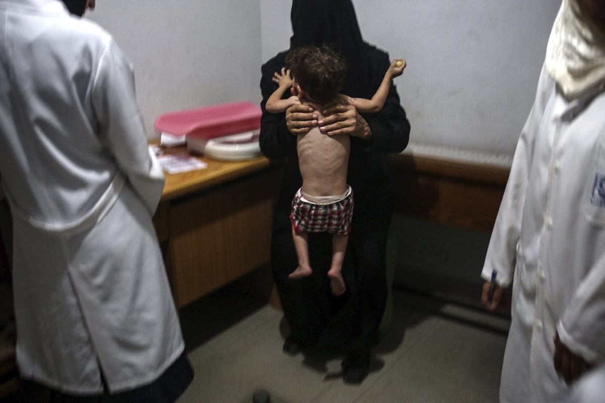 Una madre espera a que su hijo, quien padece desnutrición, sea atendido en la consulta de un médico en Siria. (Foto Prensa Libre: EFE).