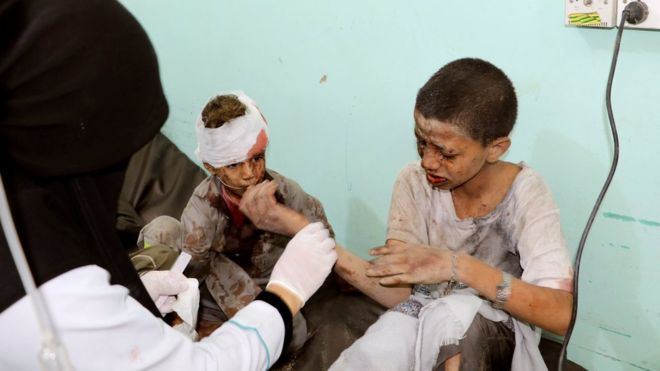 Unos 29 niños murieron y otros 30 resultaron heridos durante al ataque. (Reuters)
