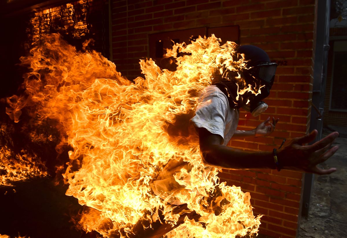 Momento en que un joven venezolano ardía en llamas luego de que fuera alcanzado accidentalmente por gasolina. (Foto Prensa Libre: AFP)