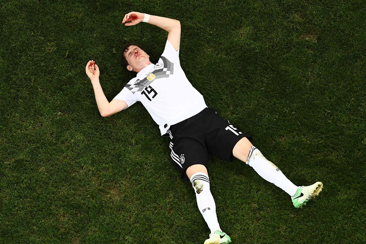 El jugador alemán Sebastian Rudy tuvo que ser atendido por los médicos, en el juego frente a Suecia. (Foto Prensa Libre: AFP)