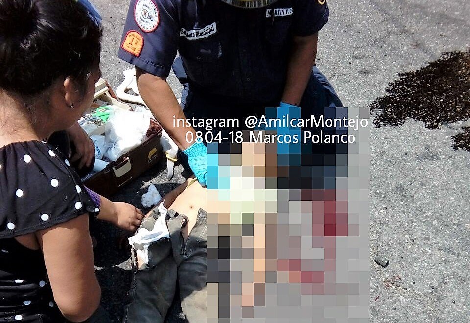 El menor viajaba en la motocicleta junto a su tío, cuando ocurrió el incidente. (Foto Prensa Libre: Amílcar Montejo)