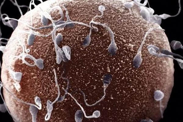 <br _mce_bogus="1"/>