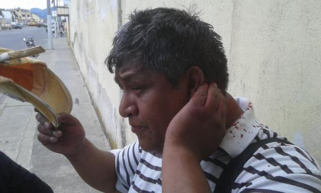 Ventura sufrió una herida en la cabeza mientras cubría unos operativos en Quetzaltenango. (Foto Prensa Libre)