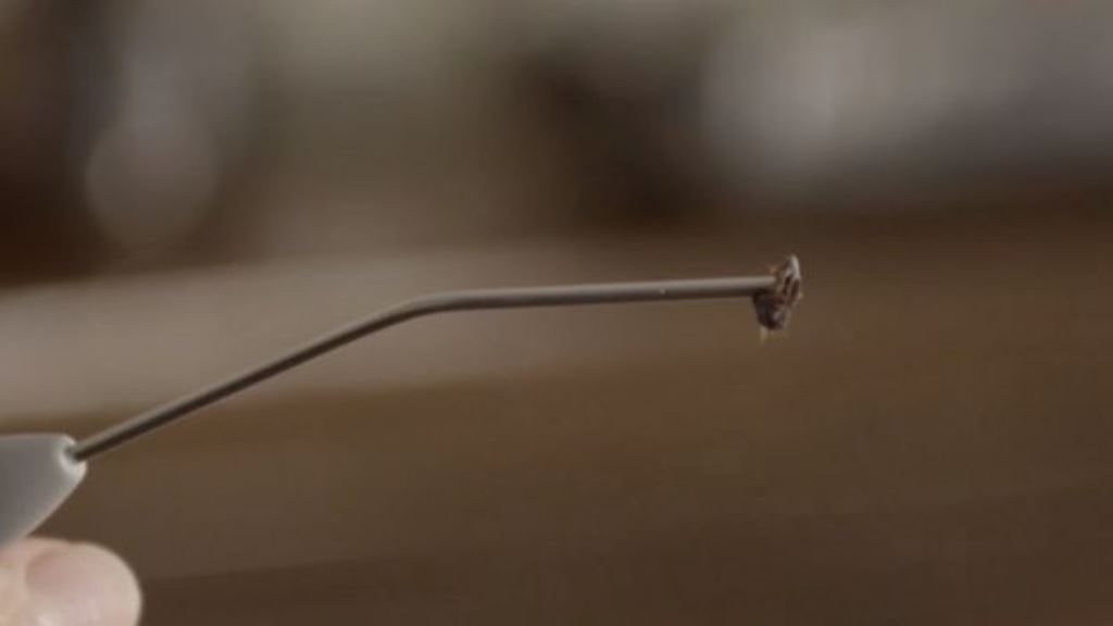 Tapón de cera extraído por un médico.