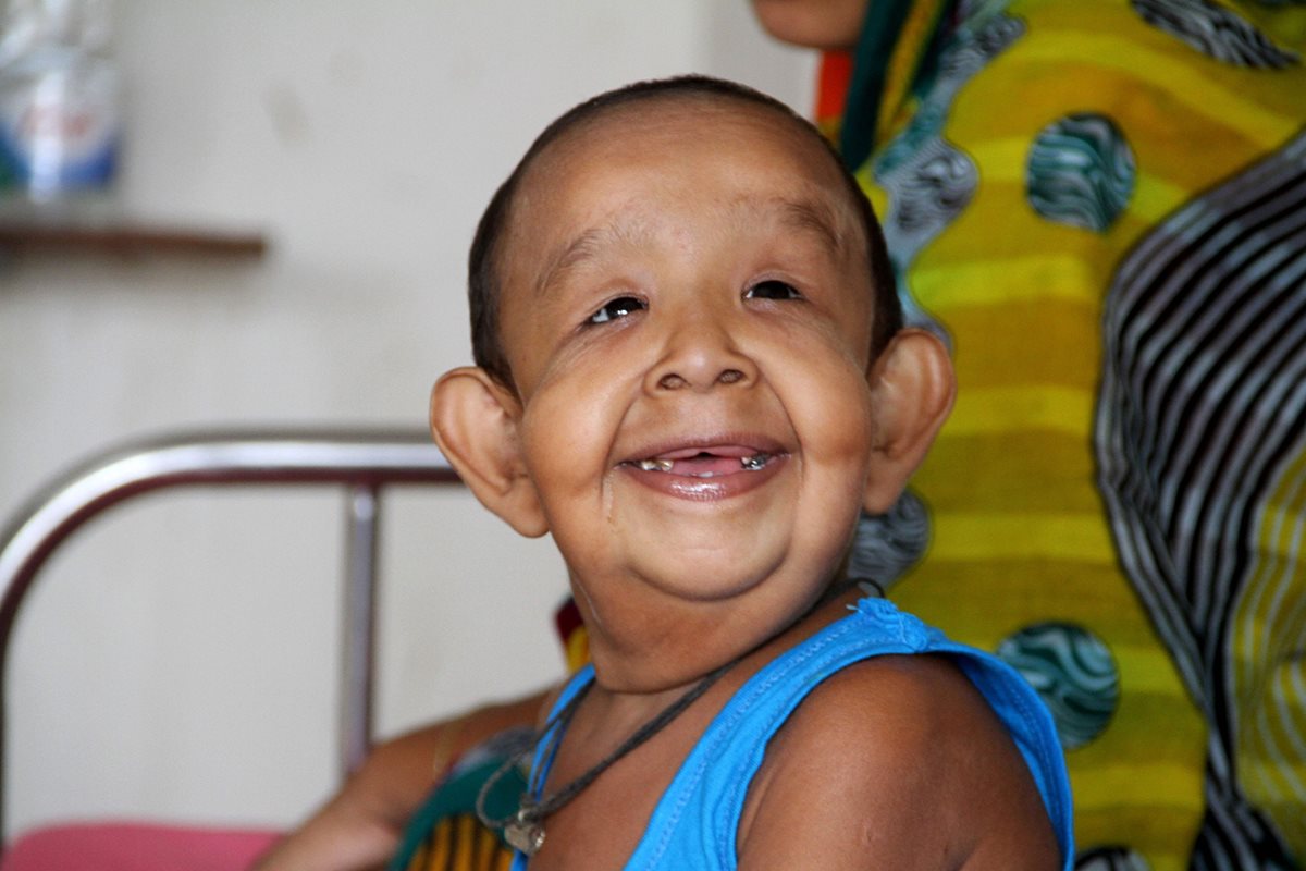 El niño bangladesí Bayezid Shikdar, padece una extraña enfermedad que le hace parecer anciano. (Foto Prensa Libre: AFP).