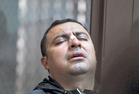 El diagnóstico preliminar indica que José Ávila Mazariegos tiene fractura en la nariz.