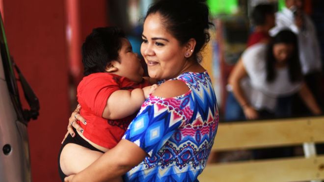 Con diez meses Luis Manuel González alcanzó un peso de 28 kilos. Y la clave para ayudarlo está en grasas que reciben los bebés a través de la sangre y la leche maternas, según el cardiólogo Gustavo Orozco. AFP