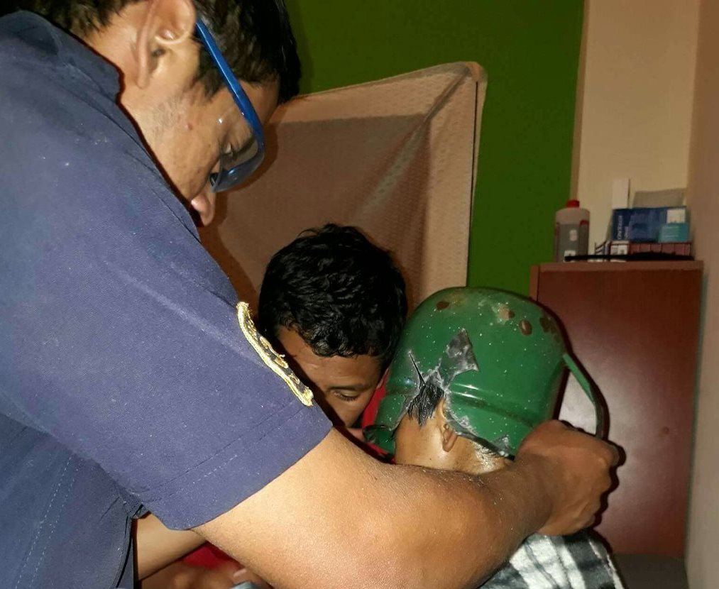 Cabeza de niño quedó atrapada dentro de un pichel de peltre con el que jugaba. (Foto Prensa Libre: CBMD)