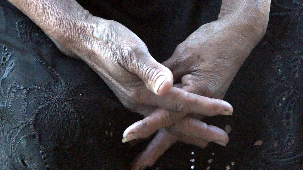 Candelaria de Jesús gana Q50 diarios cuando es época de corte de ejote, entre otros, que sirven para el sustento de su hogar. (Foto Prensa Libre: Beatriz Tercero)
