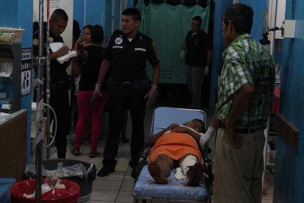Ermilda Blacida Yoc es una de las tres mujeres que fueron atropelladas en una carretera de El Tumbador, San Marcos. (Foto Prensa Libre: Alex Coyoy)