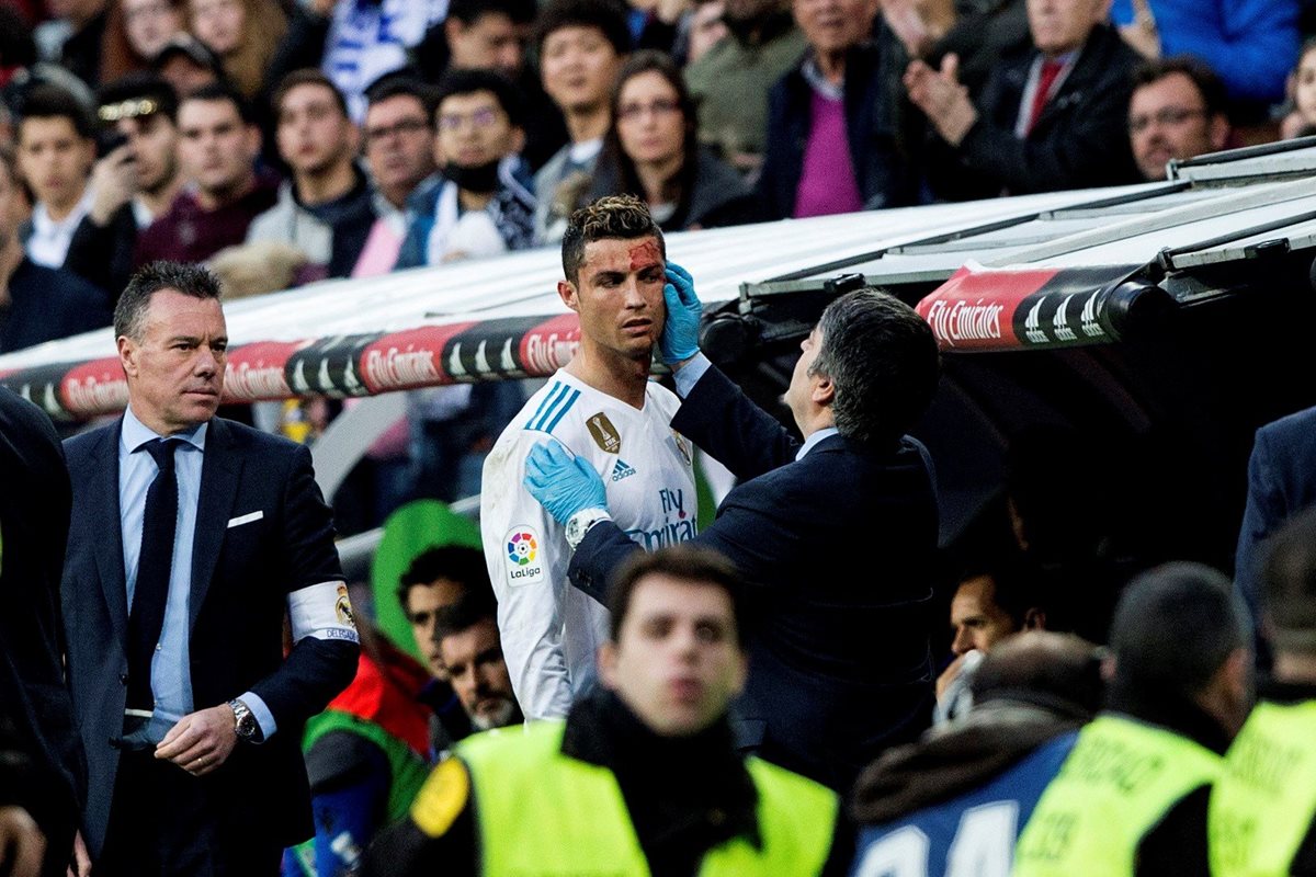 Cristiano Ronaldo es atendido por el médico del Real Madrid, luego de sufrir un corte cerca del ojo. (Foto Prensa Libre: EFE)