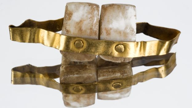 Dentadura postiza con base de oro y dos dientes inferiores. Copia de la descubierta en una tumba en Etruria, Italia, de circa 700 a.C. WELLCOME LIBRARY, LONDRES.