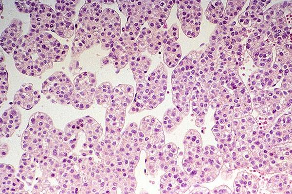 Crean células hepáticas funcionales de la piel