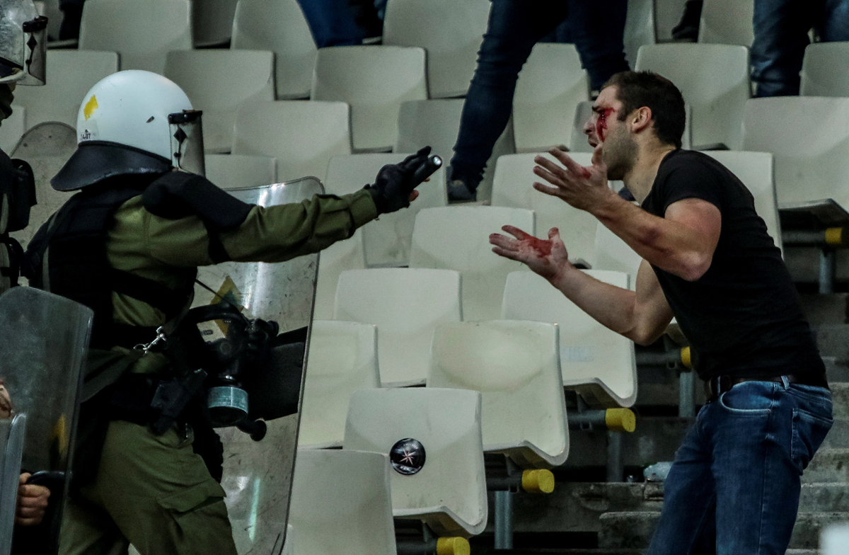 Uno de los aficioonados del Ajax que restultó herido discute con un elemento de la policía antimotines. (Foto Prensa Libre: AFP)