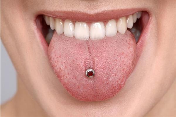Los piercings pueden causar graves lesiones y dañar los dientes y encías