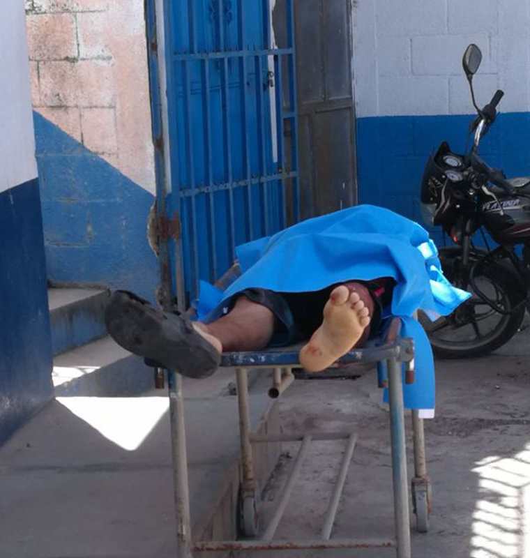 Una de las víctimas del ataque armado registrado este miércoles en el interior de una cevichería. (Foto Prensa Libre: Hugo Oliva)