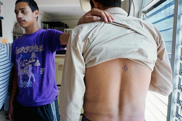 Dos hombres mostraron las heridas que supuestamente les provocaron los guardias de seguridad. (Foto Prensa Libre: Hemeroteca PL)