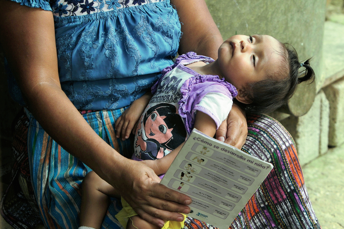Una niña de San Miguel Panán, Suchitepéquez, sufre desnutrición aguda. (Foto Prensa Libre: Hemeroteca PL).