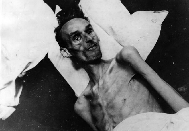 La hambruna holandesa causó estragos en un sector de la población y modificó para siempre la salud de muchos sobrevivientes. KEYSTONE/GETTY IMAGES