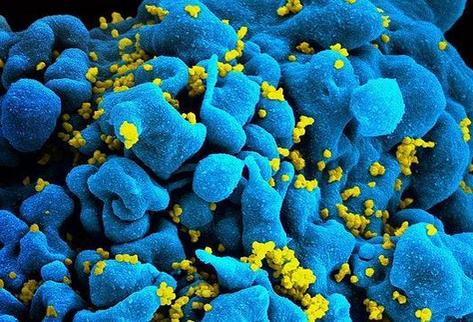 Terapia desactiva virus del sida y otros virus de transmisión sexual