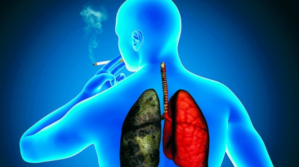 El consumo de tabaco es una de las principales causas de los problemas pulmonares. (Foto Prensa Libre: Hemeroteca PL).
