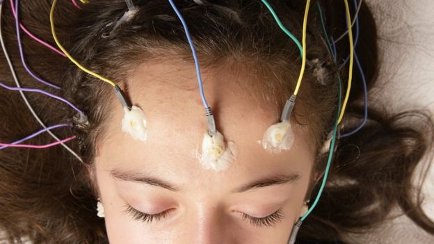 El uso de electrodos ya no es algo del futuro. (Foto Prensa Libre: GETTY IMAGES)